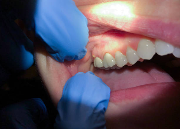 Best Emergency Treatment for Jaw Pain or Injury in Kailua, HI